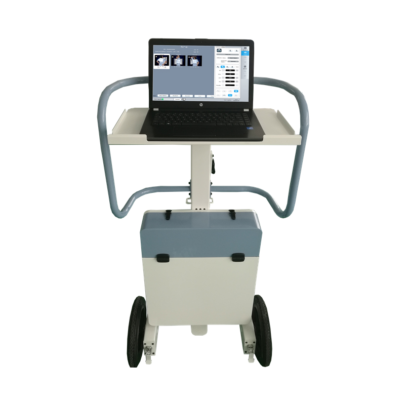 mobile digital X-ray machine